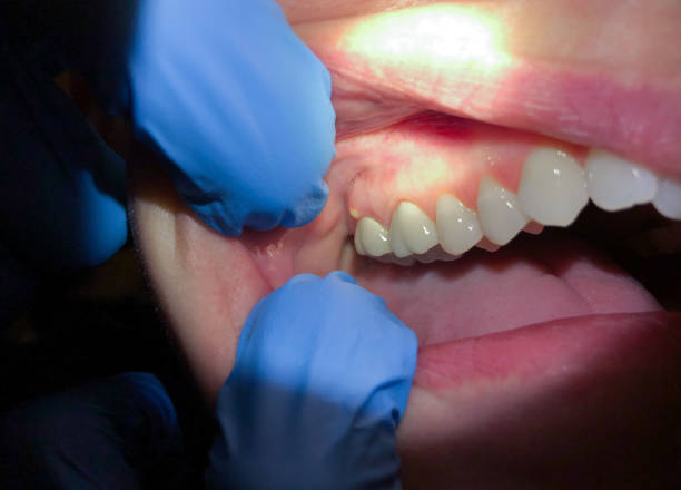 Best Emergency Denture Repair in Willis, TX